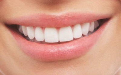 sonrisa_4