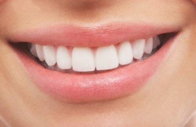 sonrisa_4