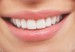 sonrisa_4