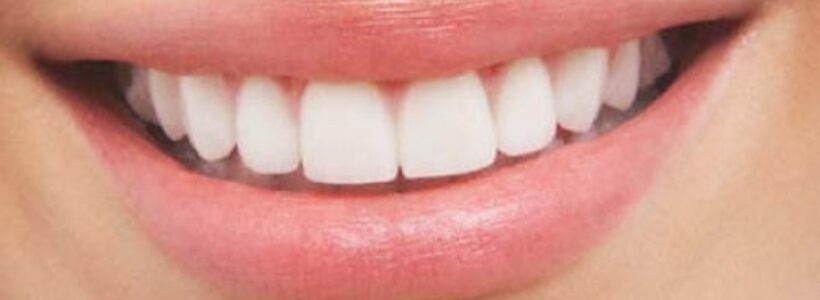 sonrisa_4