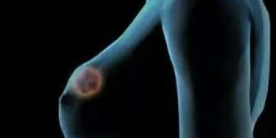 detector_casero_de_cancer_de_mama