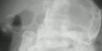 cock
