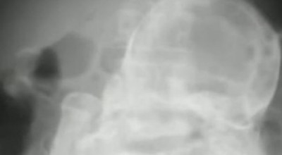 cock