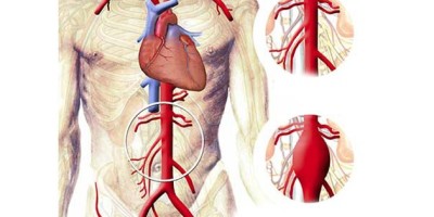 enfermdad_del_corazon