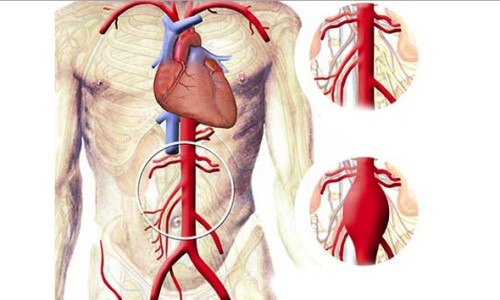 enfermdad_del_corazon