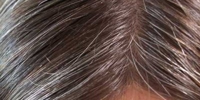pelo-canas