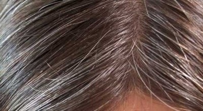 pelo-canas