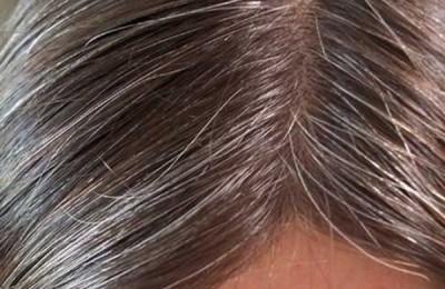 pelo-canas