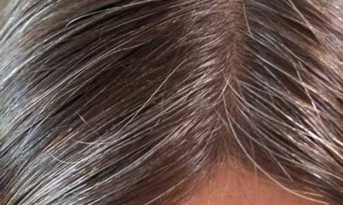 pelo-canas