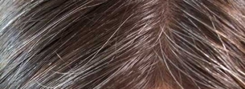 pelo-canas
